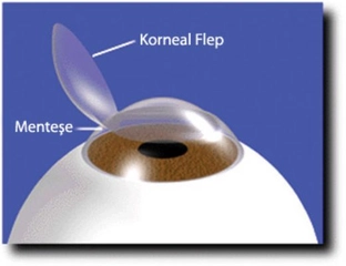 Kornea Epiteli Nedir?